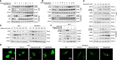 β-(4-fluorobenzyl) Arteannuin B induced interaction of ATF-4 and C/EBPβ mediates the transition of breast cancer cells from autophagy to senescence